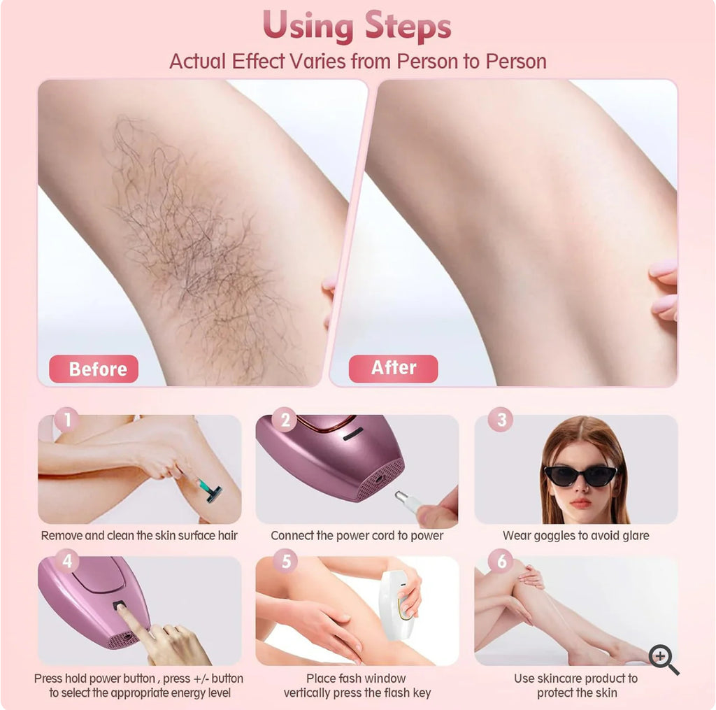 IPL Hair Removal Devices, Hair Removal, Laser Permanent Hair Removal, Laser Hair Remover,